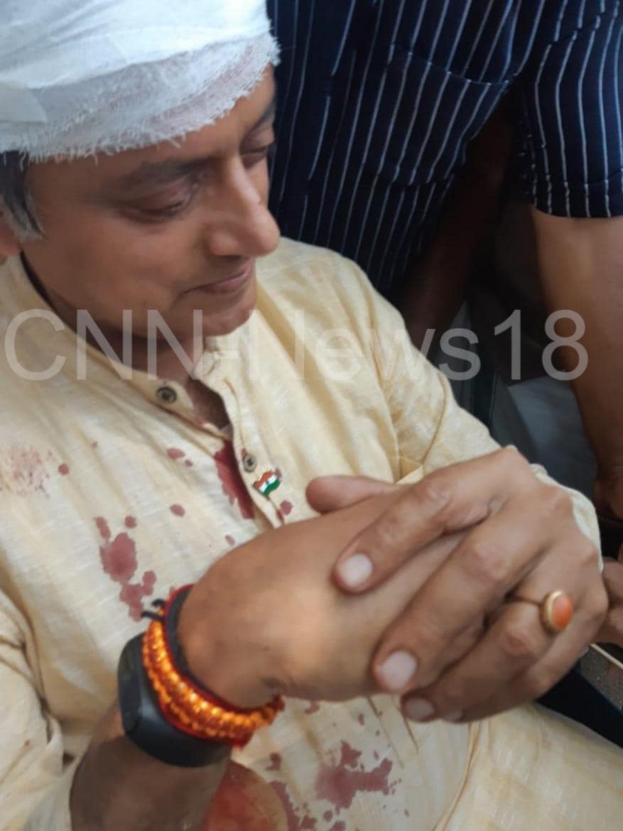 திருவனந்தபுரம் தொகுதியில் போட்டியிடும் சசி தரூர் கோவிலில் வேண்டுதல் நிறைவேற்றியதன் மூலம் காயம் அடைந்துள்ளார். திருவனந்தபுரம் தொகுதியில் போட்டியிடும் சசி தரூர் கோவிலில் வேண்டுதல் நிறைவேற்றியதன் மூலம் காயம் அடைந்துள்ளார்.