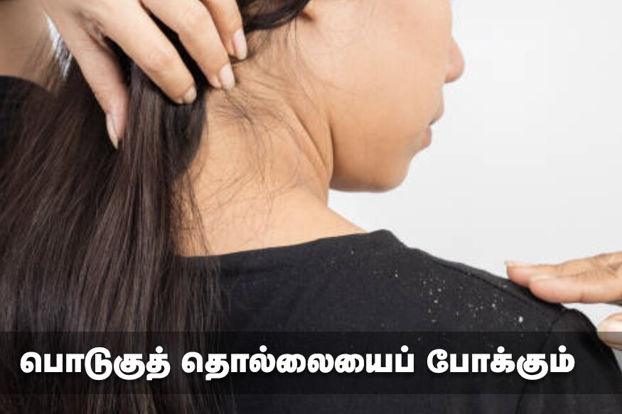 பொடுகுத் தொல்லையைப் போக்கும் : வெந்தயம் நச்சு நீக்கி மட்டுமல்ல பூஞ்சைகளை அழிக்கும் வல்லமையும் கொண்டது. ஊறவைத்த வெந்தயத்தை அறைத்து அதோடு தயிர் சேர்த்து தலையில் தேய்த்துக் குளித்தால் பொடுகுத் தொல்லை நீங்கும். பொடுகுத் தொல்லையைப் போக்கும் : வெந்தயம் நச்சு நீக்கி மட்டுமல்ல பூஞ்சைகளை அழிக்கும் வல்லமையும் கொண்டது. ஊறவைத்த வெந்தயத்தை அறைத்து அதோடு தயிர் சேர்த்து தலையில் தேய்த்துக் குளித்தால் பொடுகுத் தொல்லை நீங்கும்.