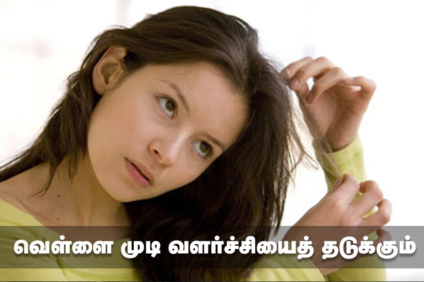 வெள்ளை முடி வளர்ச்சியைத் தடுக்கும் : 20 வயதிலேயே முளைக்கும் வெள்ளை முடி வளர்ச்சியைத் தடுக்க வெந்தயத்திலுள்ள பொட்டாசியம் தடுக்க உதவும். ஊறவைத்த வெந்தயத்தை அரைத்து அதோடு பெரிய நெல்லிக்காய் சாறை சேர்த்து தலைமுடி வேர்களில் தடவி தலைக்குக் குளியுங்கள். வெள்ளை முடியைத் தவிர்க்கலாம். வெள்ளை முடி வளர்ச்சியைத் தடுக்கும் : 20 வயதிலேயே முளைக்கும் வெள்ளை முடி வளர்ச்சியைத் தடுக்க வெந்தயத்திலுள்ள பொட்டாசியம் தடுக்க உதவும். ஊறவைத்த வெந்தயத்தை அரைத்து அதோடு பெரிய நெல்லிக்காய் சாறை சேர்த்து தலைமுடி வேர்களில் தடவி தலைக்குக் குளியுங்கள். வெள்ளை முடியைத் தவிர்க்கலாம்.