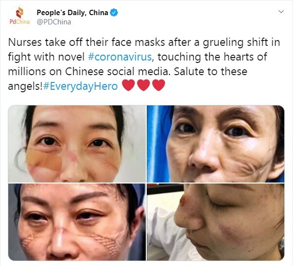 இந்த புகைப்படங்களை சீனா நாளிதழ் தனது சமூகவலைதளத்தில் வெளியிட்டுள்ளது. தன்னலமற்ற செவிலியர்களின் சேவைக்கு பலர் பாராட்டு தெரிவித்து வருகின்றனர். இந்த புகைப்படங்களை சீனா நாளிதழ் தனது சமூகவலைதளத்தில் வெளியிட்டுள்ளது. தன்னலமற்ற செவிலியர்களின் சேவைக்கு பலர் பாராட்டு தெரிவித்து வருகின்றனர்.