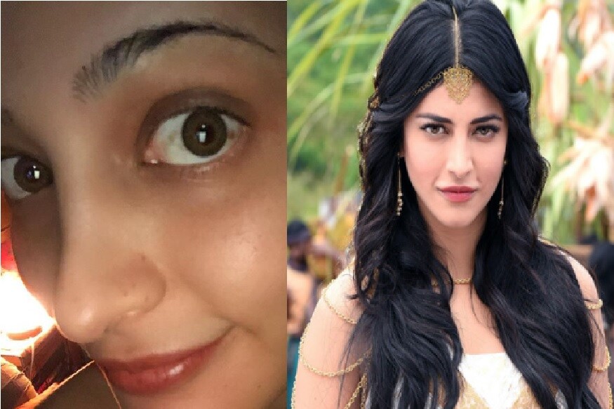 சமீபத்திய இன்ஸ்டாகிராம் பதிவில் தனது கண்ணைக் காட்டி, அதில் உள்ள கருப்பு அடையாளத்தை ரசிப்பதாக நடிகை ஸ்ருதிஹாசன் கூறியுள்ளார். சமீபத்திய இன்ஸ்டாகிராம் பதிவில் தனது கண்ணைக் காட்டி, அதில் உள்ள கருப்பு அடையாளத்தை ரசிப்பதாக நடிகை ஸ்ருதிஹாசன் கூறியுள்ளார்.