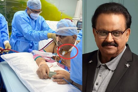எஸ்.பி.பிக்கு கொடுக்கப்பட்ட டிரக்யாஸ்டமி சிகிச்சையை வெளியே சொல்லாதது ஏன்? - எஸ்.பி.பி.சரண் விளக்கம் எஸ்.பி.பிக்கு கொடுக்கப்பட்ட டிரக்யாஸ்டமி சிகிச்சையை வெளியே சொல்லாதது ஏன்? - எஸ்.பி.பி.சரண் விளக்கம்