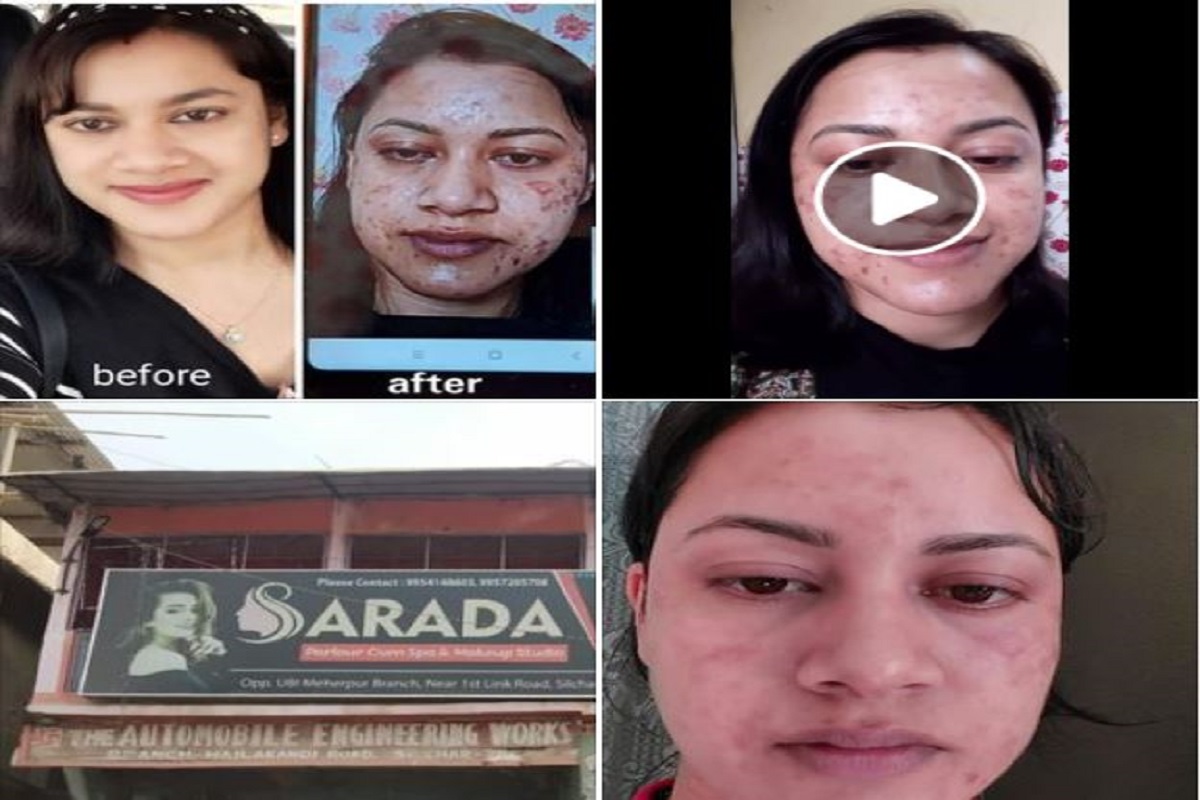 பியூட்டி பார்லரில் ஃபேஷியல் செய்த பெண்ணுக்கு முகம் சிதைந்த கொடுமை