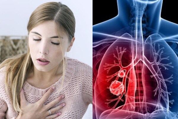 நுரையீரல் , சுவாசப் பாதையின் ஆரோக்கியத்தை அதிகரிக்கும் உணவுகள்