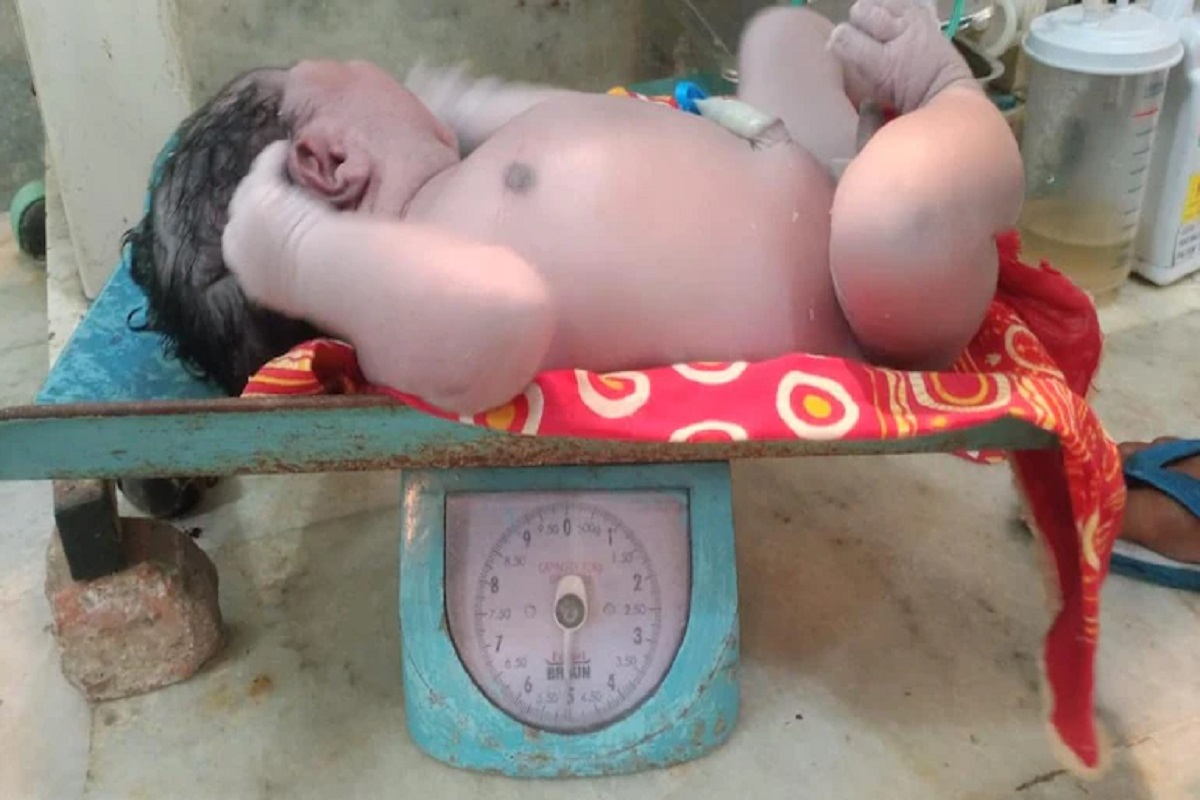அதிக எடையுள்ள குழந்தையை பெற்றெடுத்து அசாம் பெண் சாதனை!