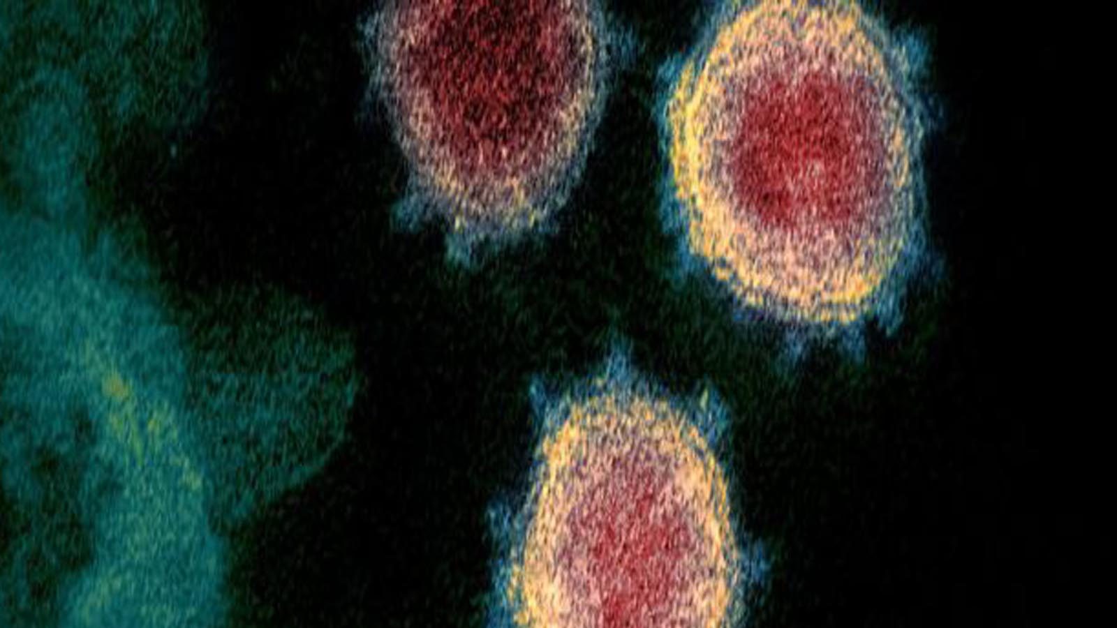 ''தென் ஆப்பிரிக்க நாடுகளில் இருந்து வரும் விமானங்களை தடை செய்யுங்கள்'' : மோடிக்கு கெஜ்ரிவால் அவசர கோரிக்கை