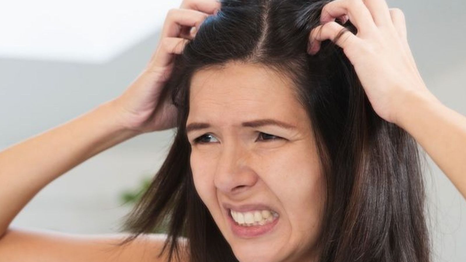 அதிகரிக்கும் பொடுகுத்தொல்லை அரிப்பு : இதற்கு என்னதான் தீர்வு..? இதை படியுங்கள்..!