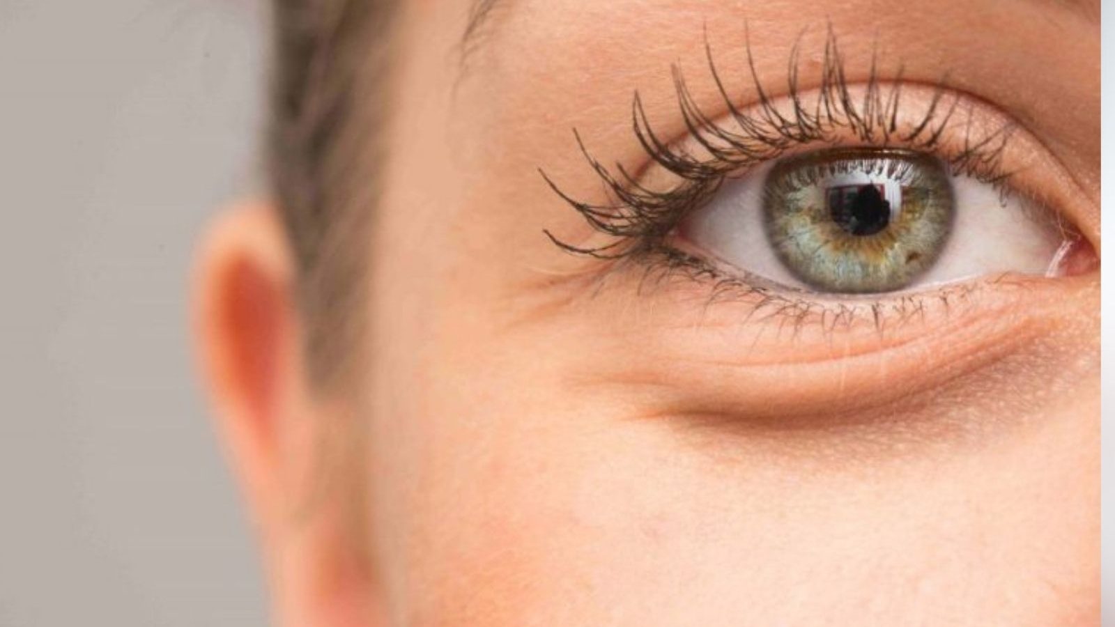 கண்கள் வீங்குவதற்கான காரணங்கள் என்ன.? சரி செய்ய டிப்ஸ்