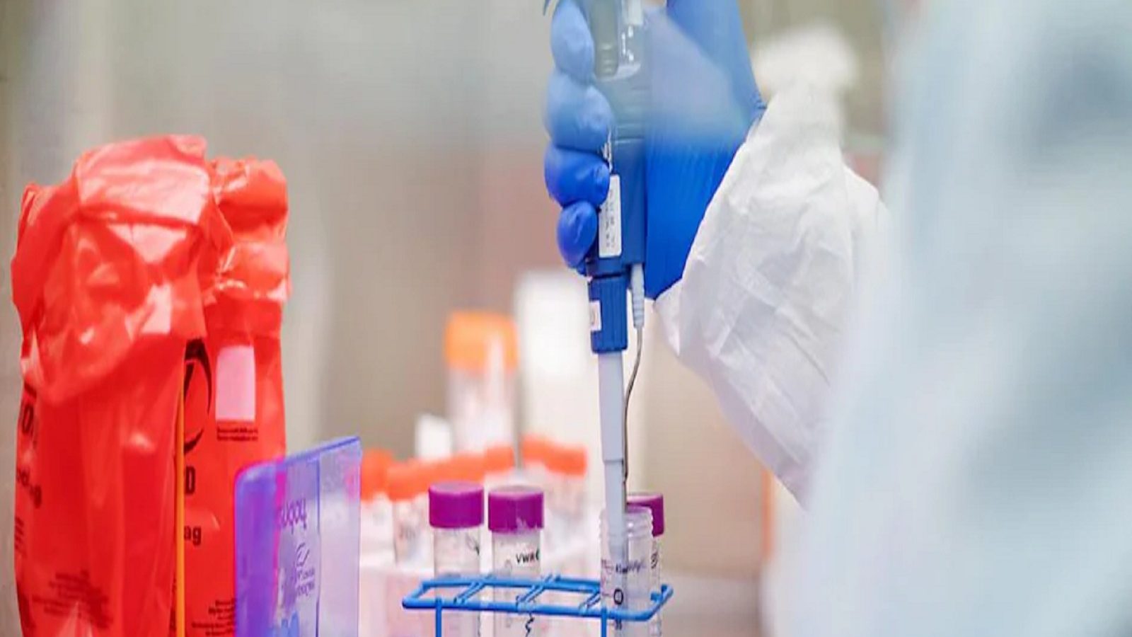 ஓமைக்ரானை கண்டறியும்  டாடா நிறுவனத்தின் OmiSure டெஸ்ட் கிட் - ஐசிஎம்ஆர் ஒப்புதல்