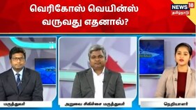 வெரிகோஸ் வெயின்ஸ் பாதிப்பு வருவது எதனால்?  சிறந்த தீர்வுகள் என்ன? - மருத்துவர்கள் விளக்கம்