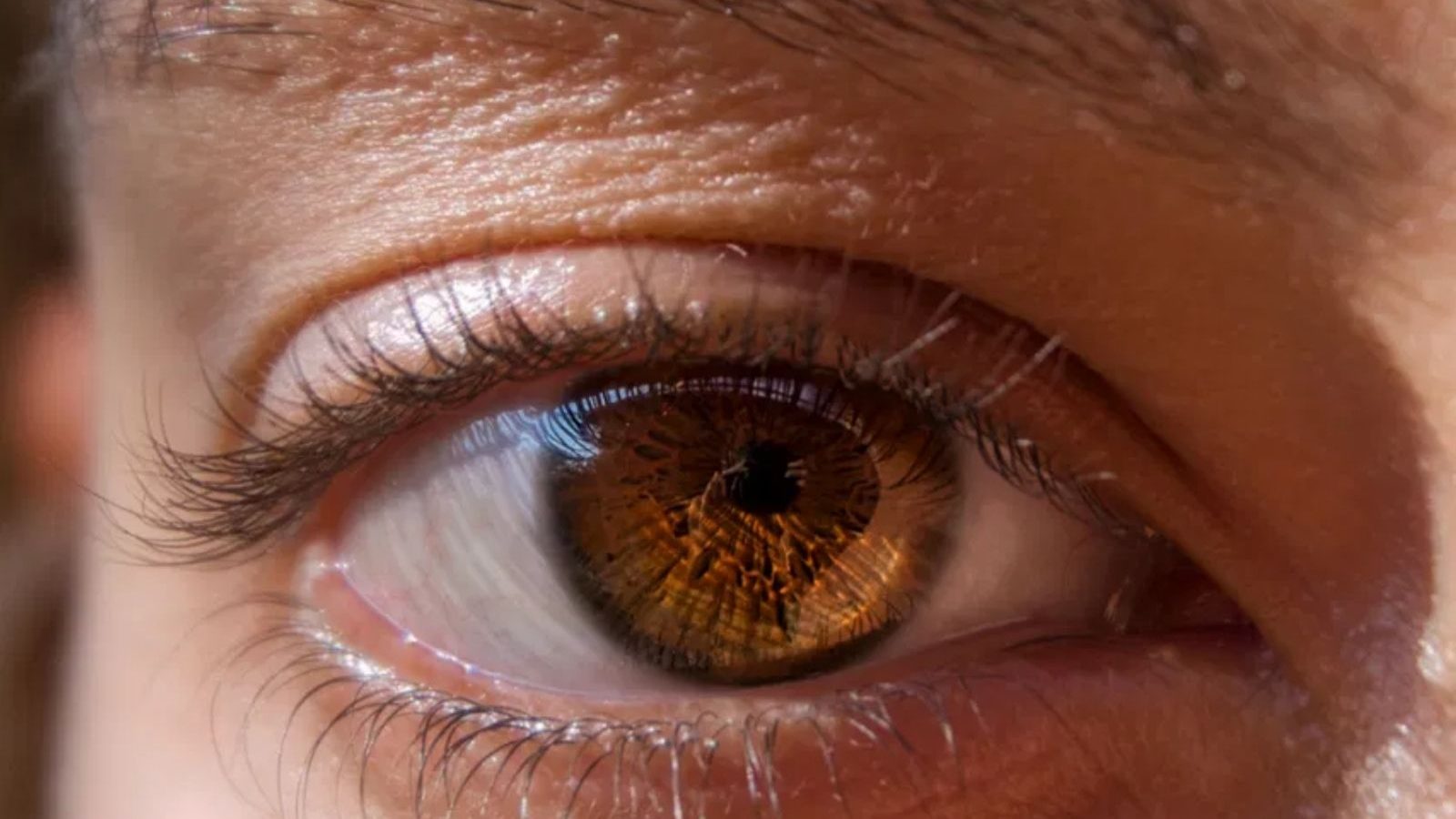 ரெடினோபதி என்றால் என்ன? இது எப்படி ஏற்படுகிறது என்பதை தெரிந்து கொள்ளுங்கள்