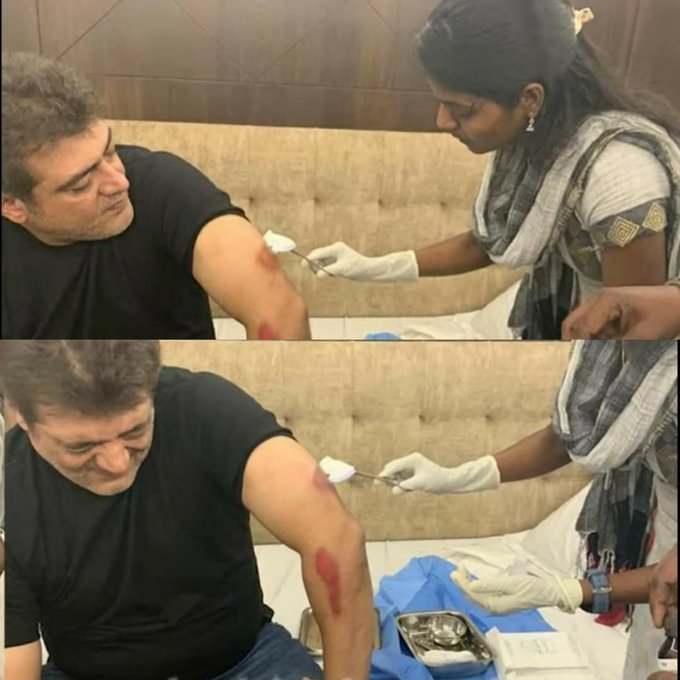 Ajith with injuries for Valimai movie - Picture goes viral on twitter, valimai, valimai release date, ajith injury valimai, ajith injured valimai, அஜித் காயம், காயங்களுடன் அஜித், valimai ticket booking, valimai cast, valimai twitter, valimai update, valimai booking, valimai movie download, ajith injury, வலிமை bgm, வலிமை டீசர், வலிமை சாங் டவுன்லோட், வலிமை update, serial actress srinidhi, serial actress srinidhi instagram, valimai srinidhi, srinidhi valimai, ஸ்ரீநிதி, நடிகை ஸ்ரீநிதி