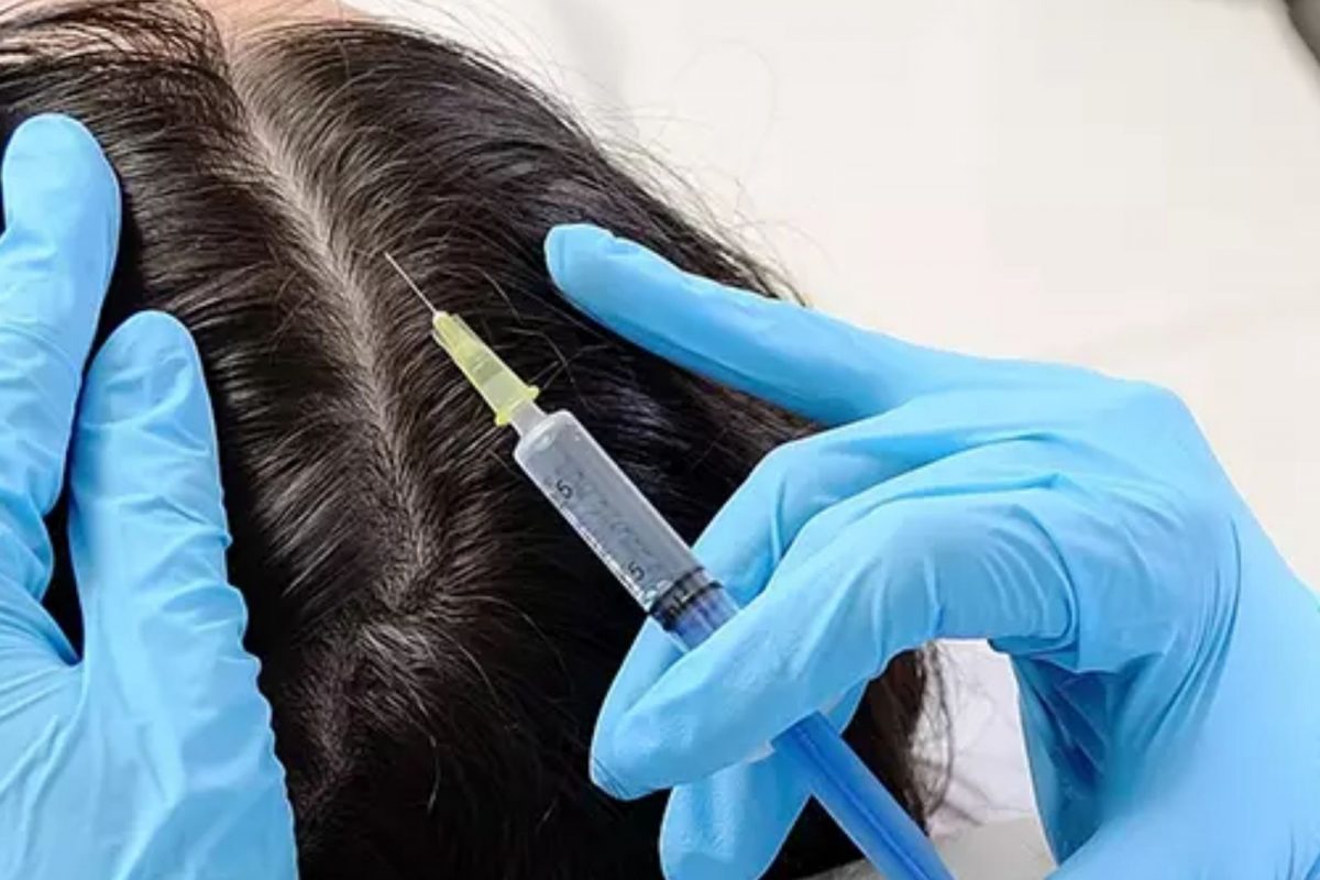 முடி வளர்ச்சியை அதிகரிக்க உதவும் சிகிச்சைகளை பற்றி தெரிந்து கொள்ளுங்கள