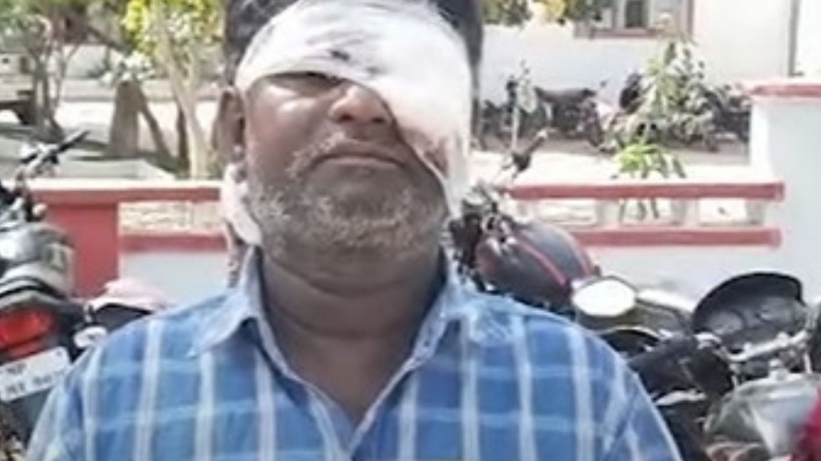 டிவி பார்ப்பதில் தகராறு..  கணவர் எனவும் பாராமல் இரும்பு கம்பியால் தாக்கிய பெண்..