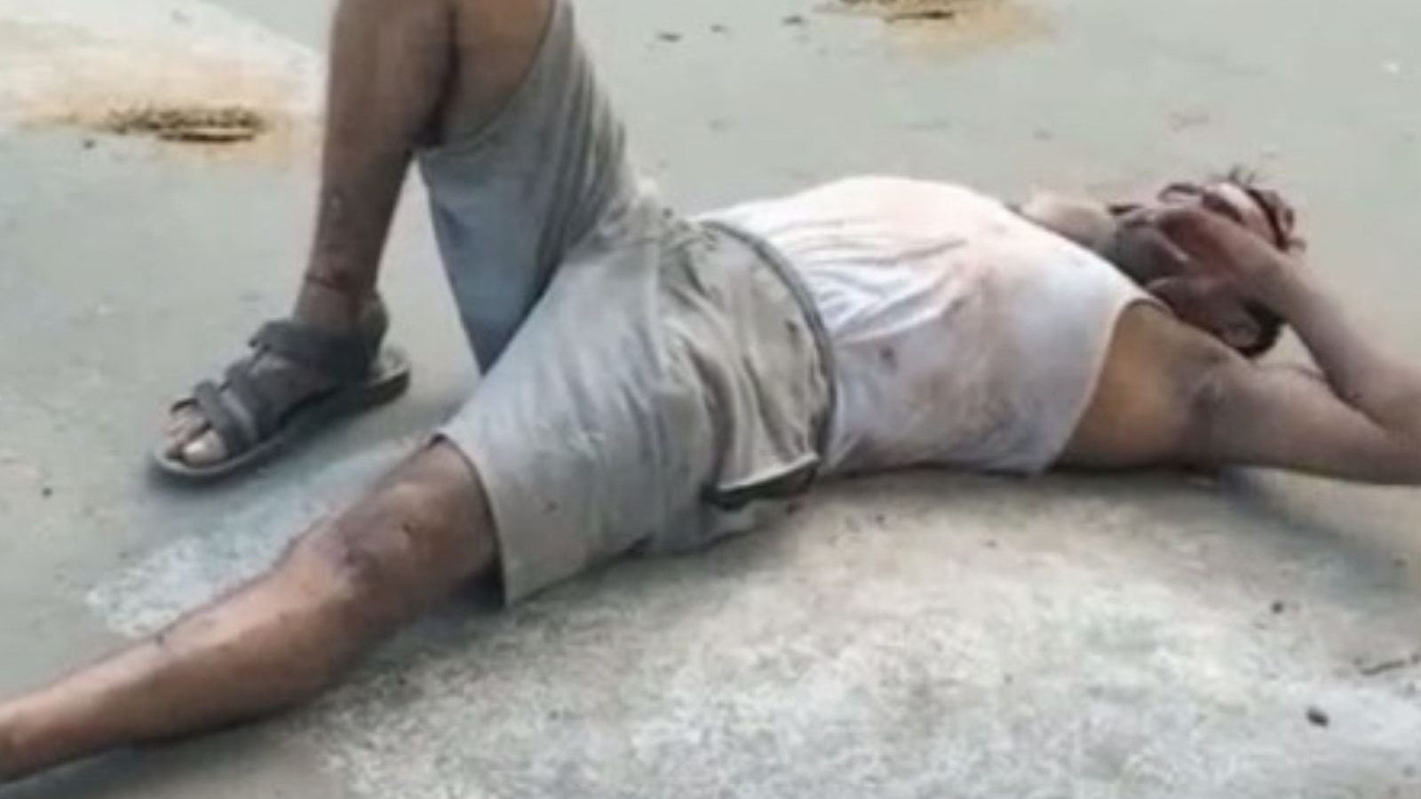 போலீஸை இங்க வரச்சொல்லு..! காவல் நிலையம் எதிரே ரத்தம் சொட்டச் சொட்ட படுத்து உருண்ட மதுப்பிரியர்.. கள்ளக்குறிச்சியில் பரபரப்பு