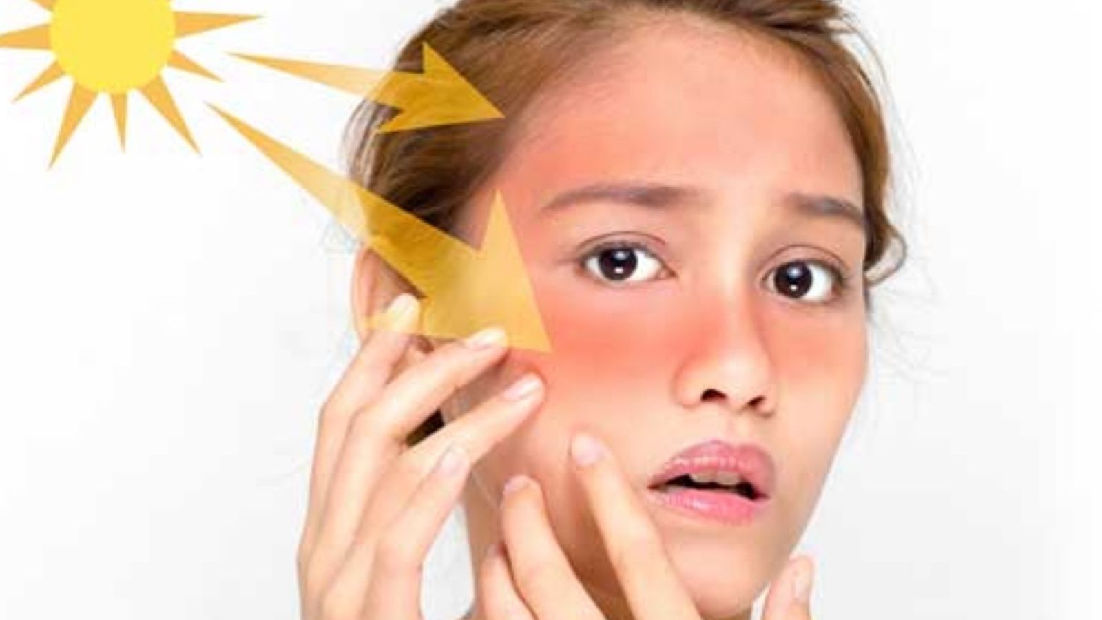 சருமத்தில் உள்ள சன் டேனை நீக்க செய்ய வேண்டியது இதுதான்... விளக்கும் சரும நிபுணர்..!