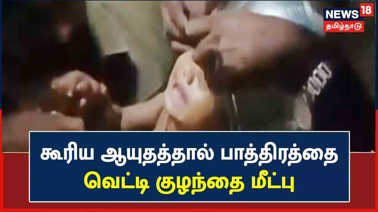 குழந்தை தலையில் மாட்டிக்கொண்ட சில்வர் பாத்திரம் - நீண்ட போராட்டத்திற்கு பின்னர் மீட்பு!