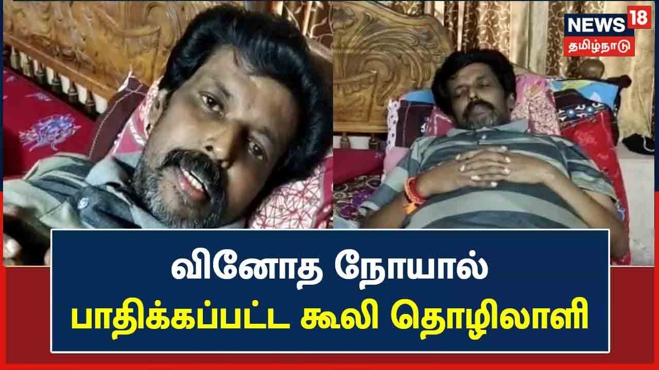 'உடலில் எங்கு தொட்டாலும் வலி '.. வினோத நோயால் பாதிக்கப்பட்ட கூலி தொழிலாளி