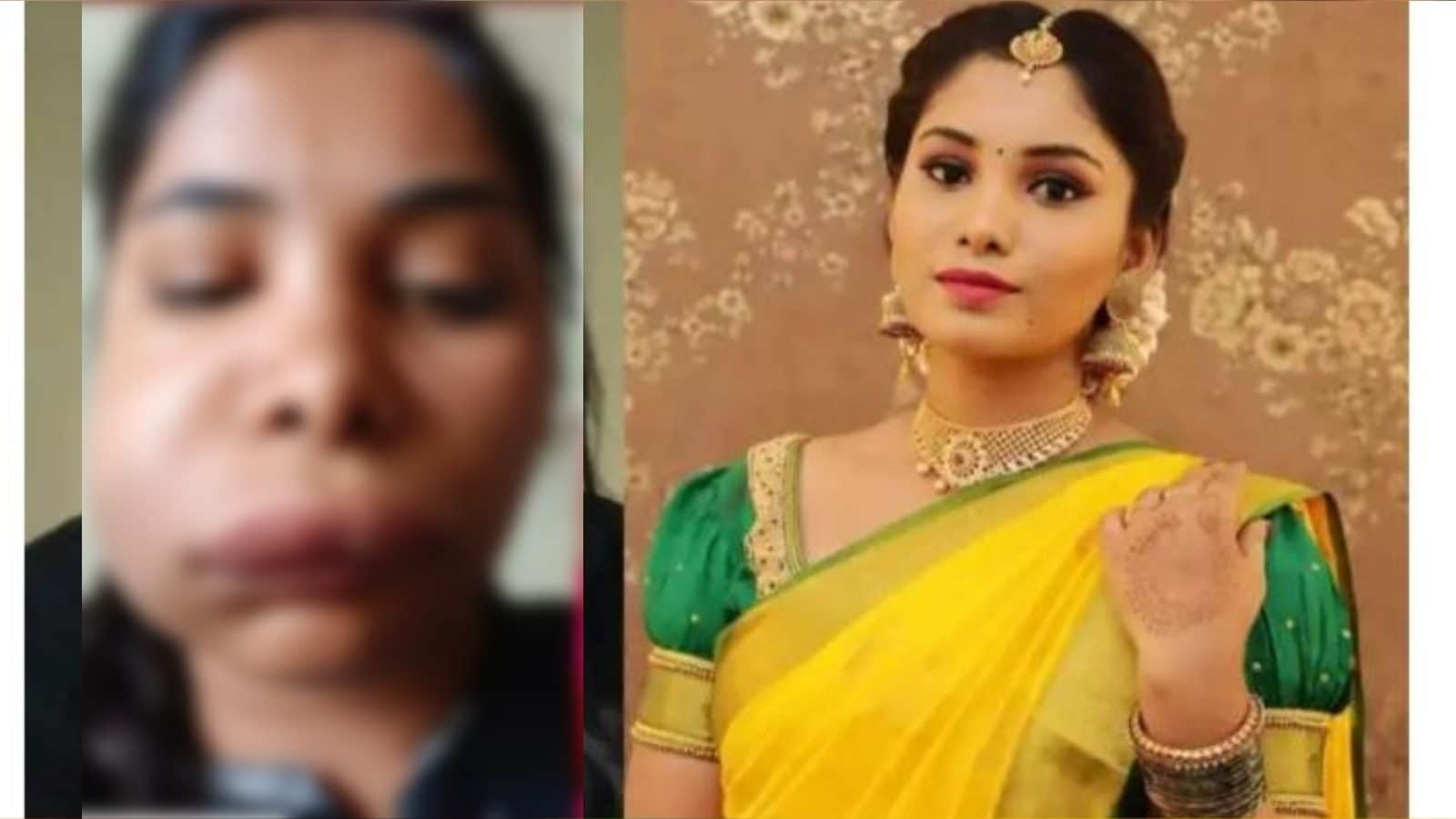 பல் வலிக்கு சிகிச்சை எடுத்த நடிகை… அழகு முகம் கோரமாக மாறிய கொடுமை