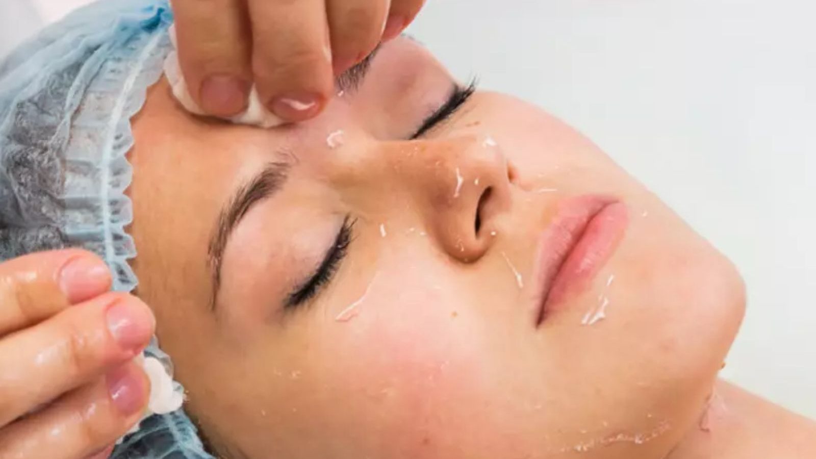 கெமிக்கல் பீல்ஸ் பற்றி நீங்கள் தெரிந்துகொள்ள வேண்டிய 3 நன்மைகள்...