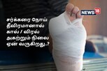 நீரிழிவு நோயில் கால் உள்ளிட்ட உறுப்புகளை அகற்றும் நிலை ஏன் வருகிறது?