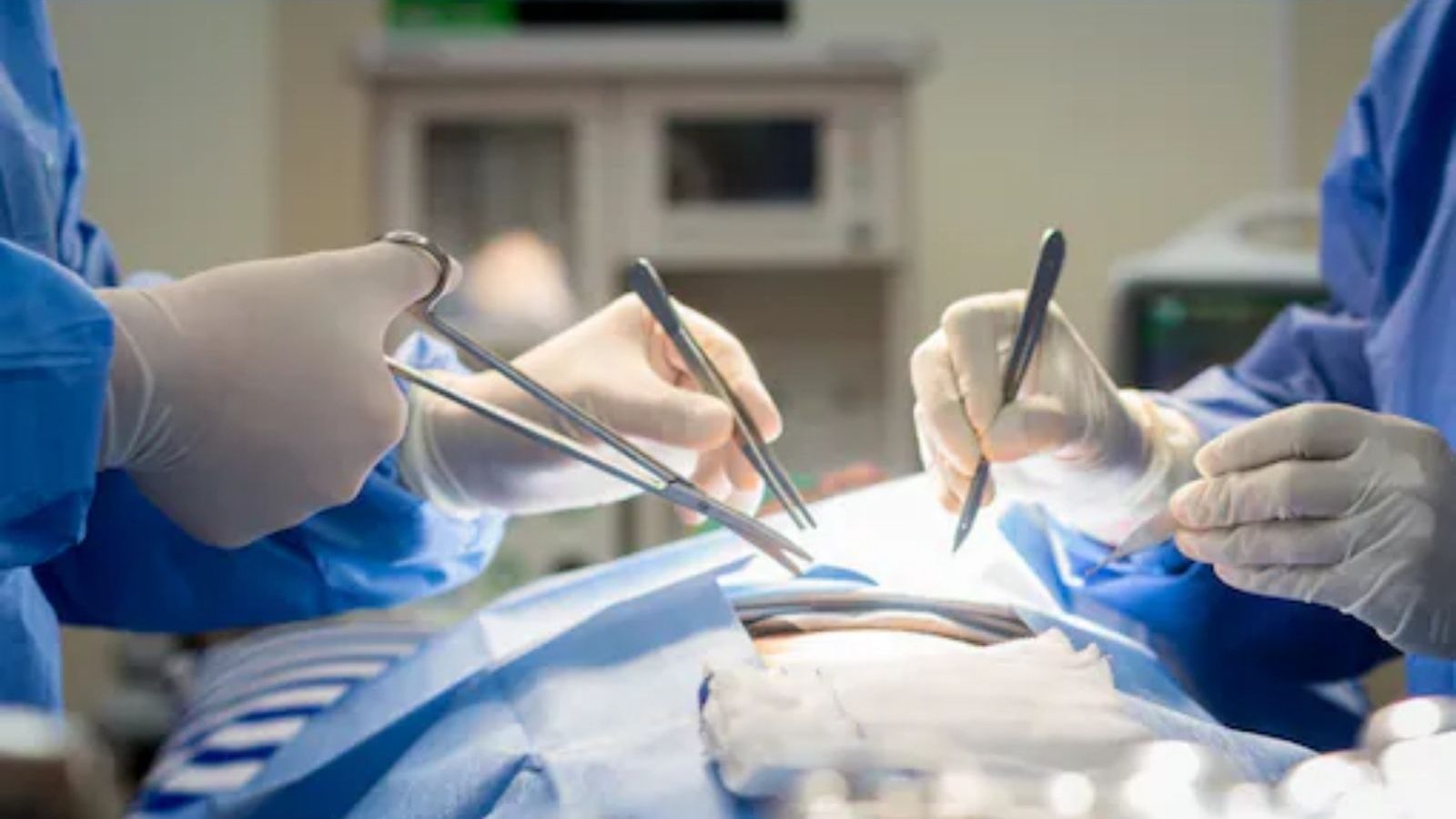 மஞ்சள் நிறத்தில் மாறிய 58 நாள் குழந்தையின் கண்கள்.. சிக்கலான கல்லீரல் மாற்று அறுவை சிகிச்சை - மருத்துவர்கள் சாதனை!