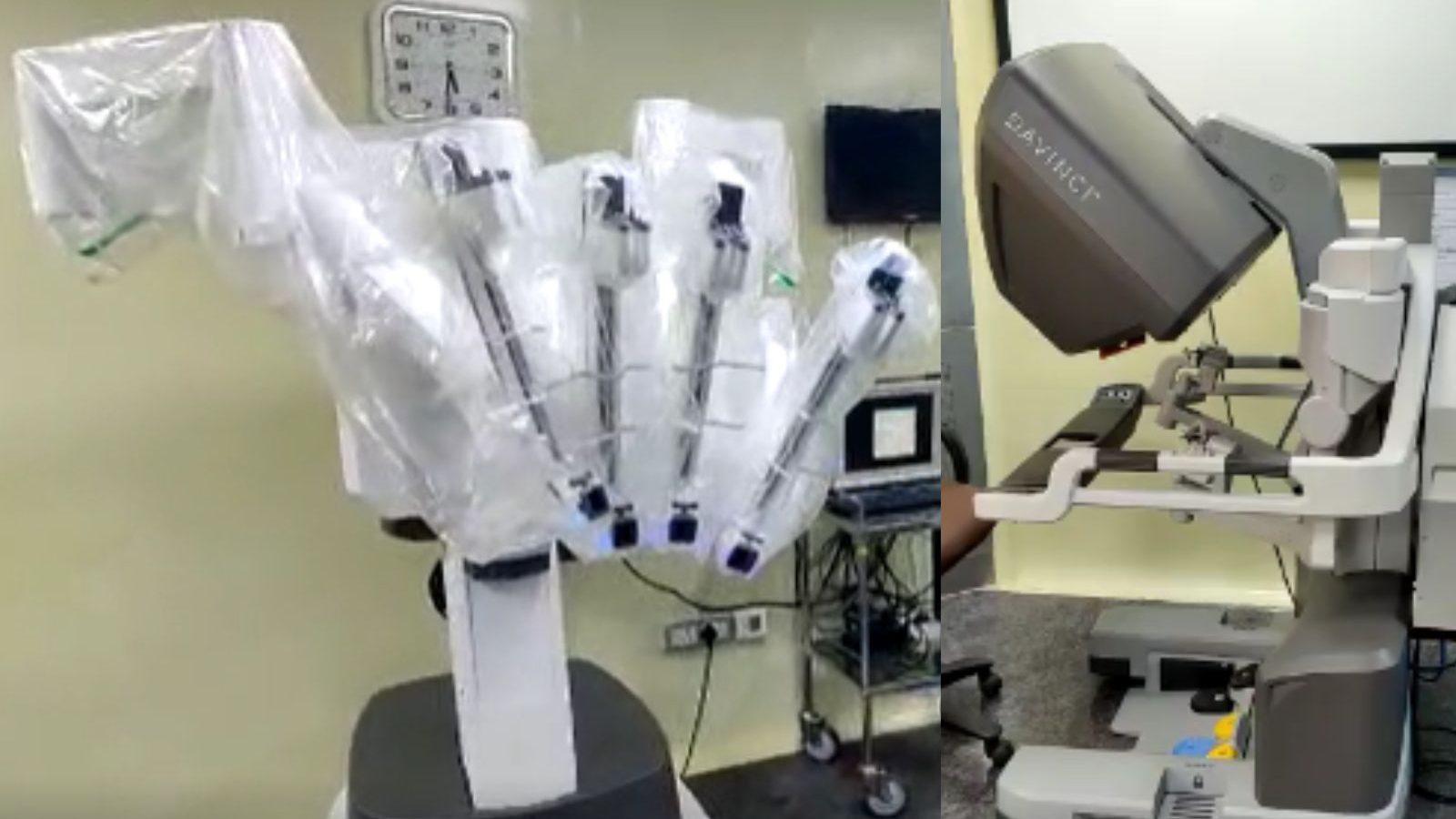 கோவை தனியார் மருத்துவமனையில் ரோபோடிக் அறுவை சிகிச்சைகள் அறிமுகம்..!