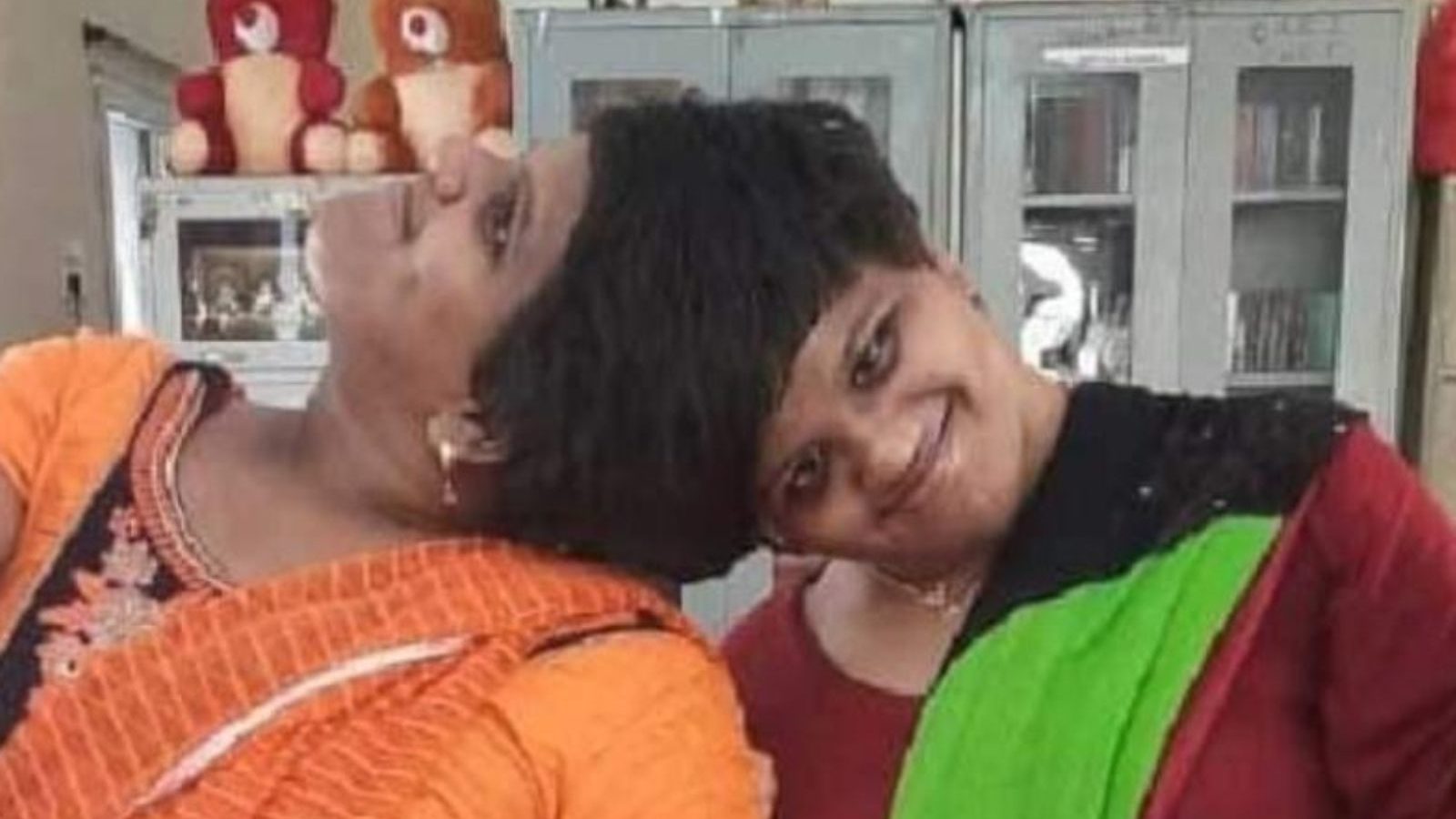 பொது தேர்வில் சாதித்த ஒட்டிப் பிறந்த இரட்டையர்கள்... CA படிக்க சாதனை பயணம்