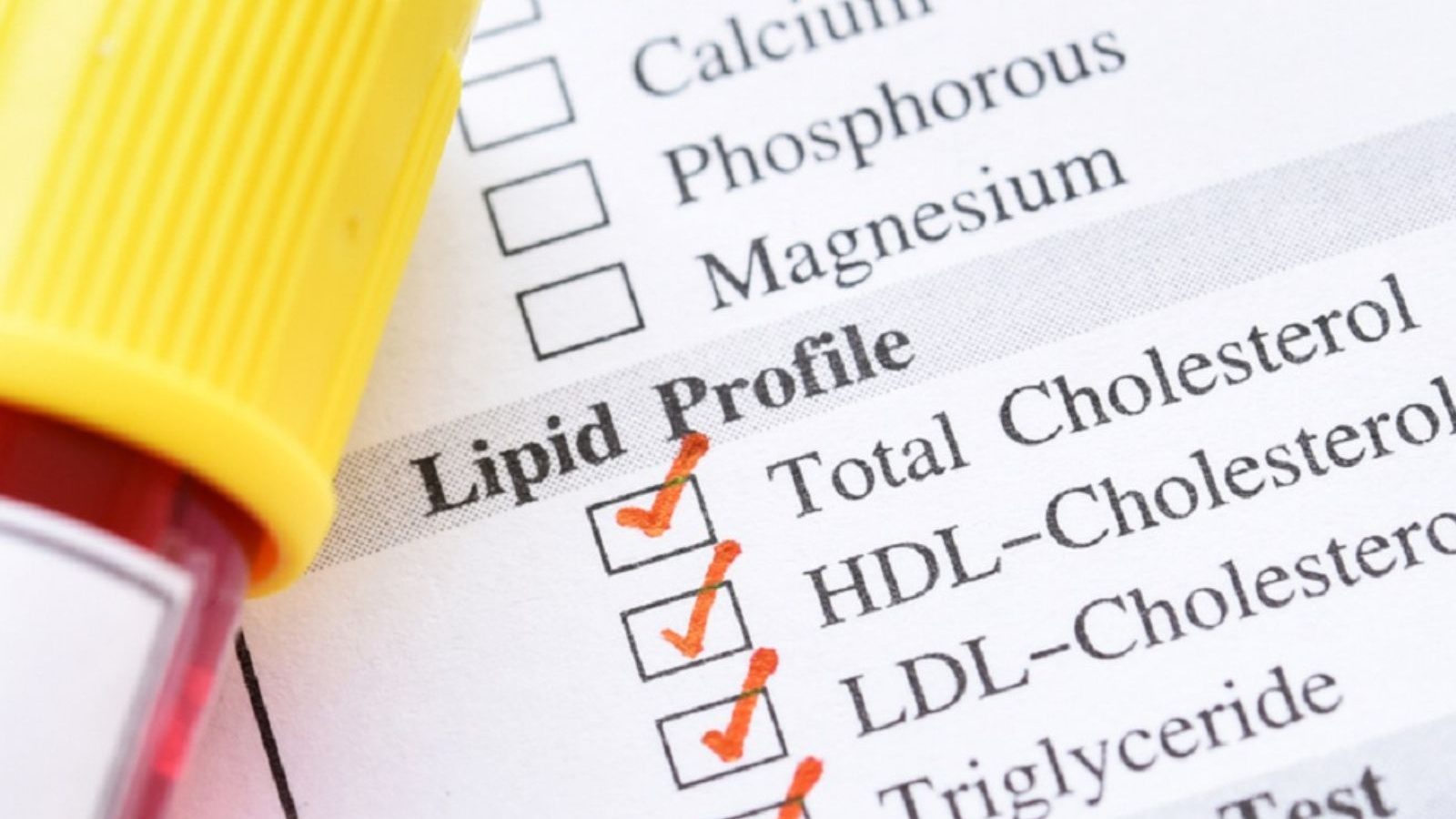 நார்மலாக உடலில் கொலஸ்ட்ரால் அளவு எவ்வளவு இருக்க வேண்டும்..? இதய நோயை உண்டாக்கு அளவு என்ன..?