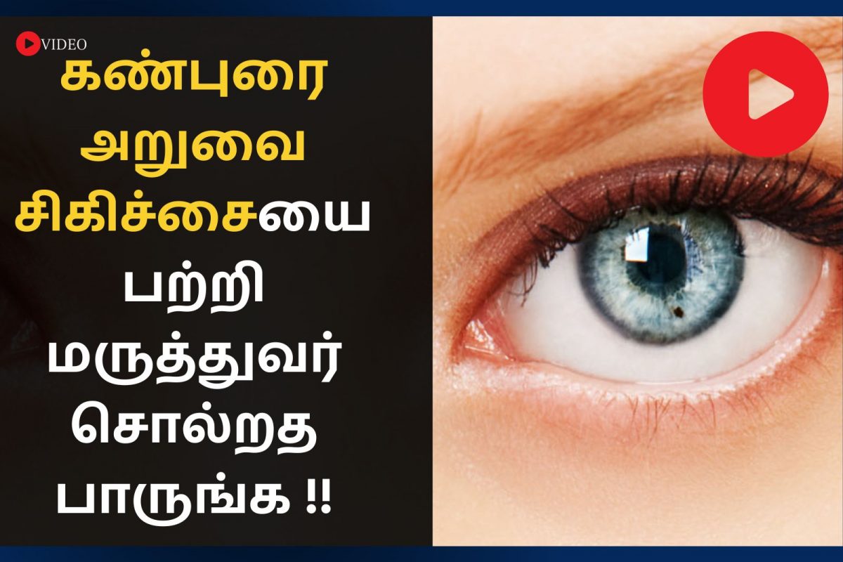 cataracts