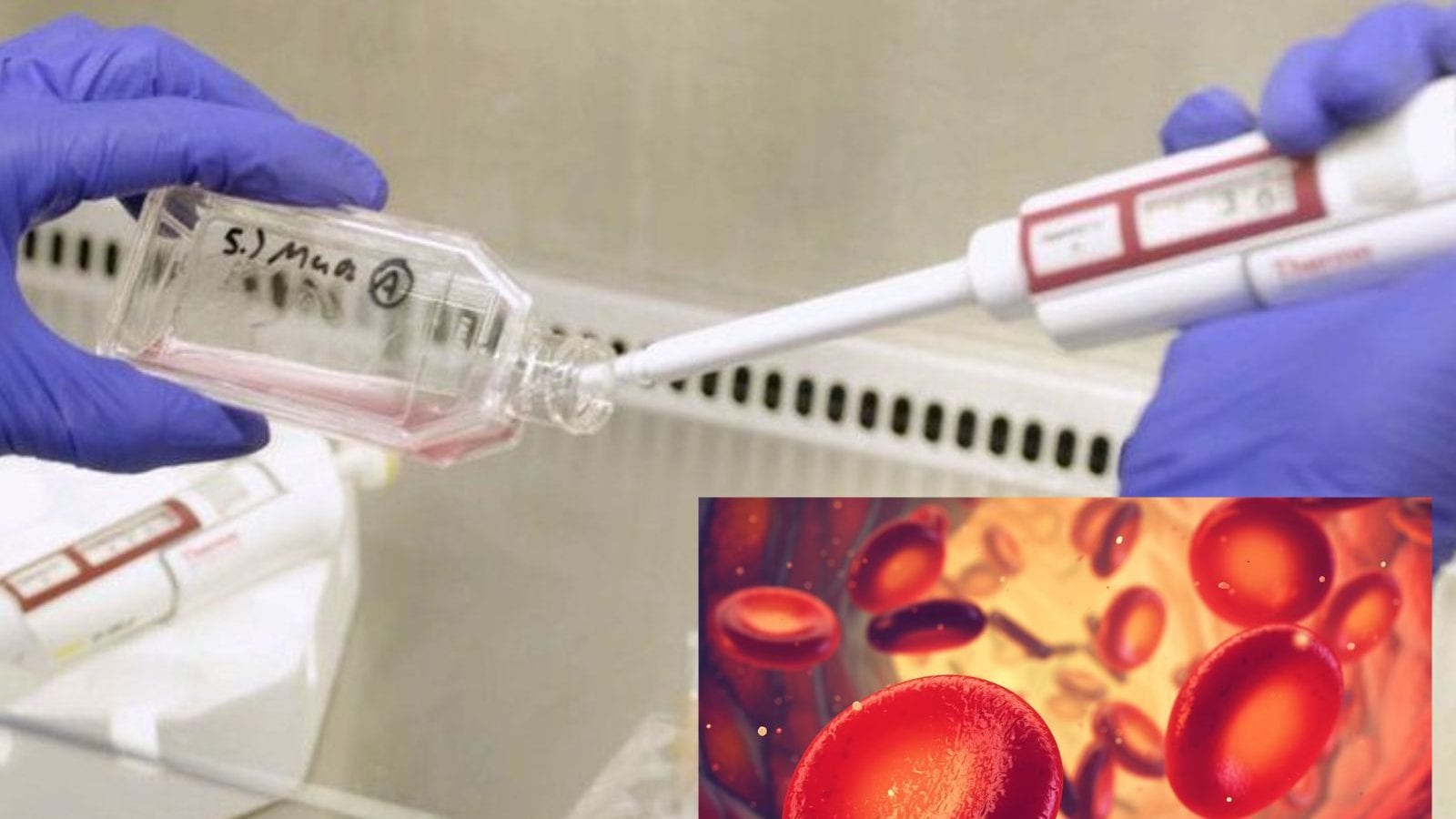 இது நடந்துட்டா சாதனைதான்... ஆய்வகத்தில் தயாரிக்கப்படும் மனித ரத்தம்! சாதிக்குமா மருத்துவத்துறை?