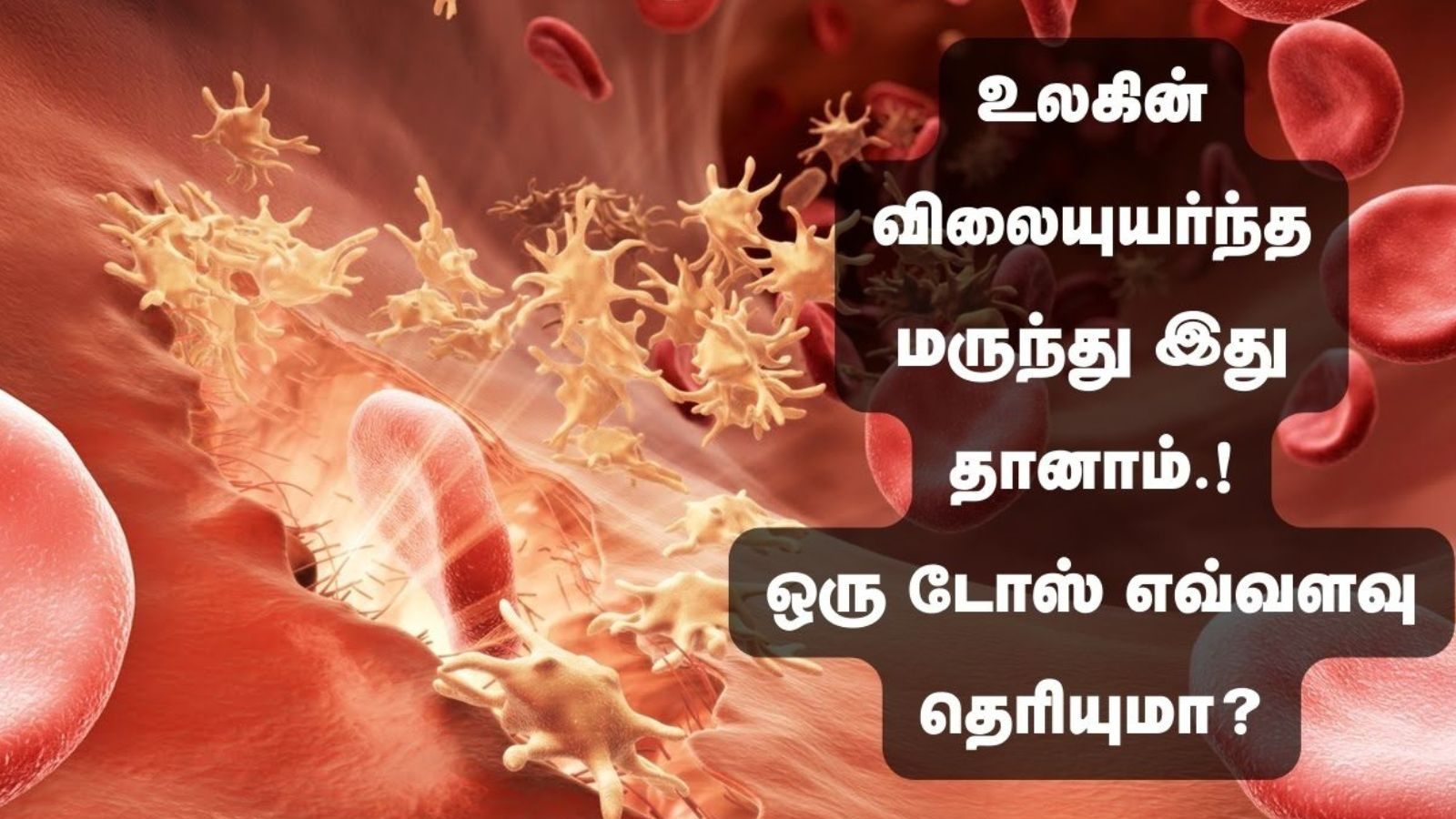 உலகின் விலையுயர்ந்த மருந்து இது தானாம்..! ஒரு டோஸ் எவ்வளவு..? எந்த நோய்க்கு போடப்படுகிறது..?