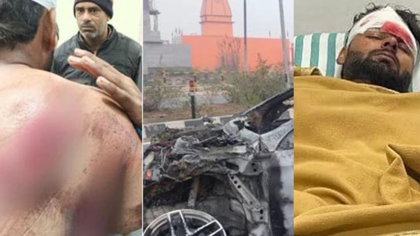 கார் விபத்தில் சிக்கி படுகாயம்… கிரிக்கெட் வீரர் ரிஷப் பந்த்தின் நிலைமை என்ன?