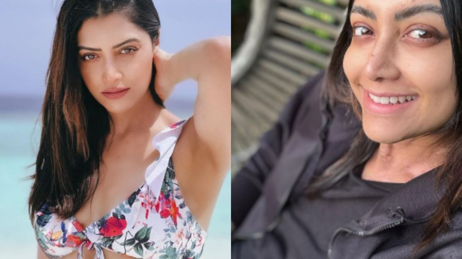 'இப்படி ஒரு நோய்... நிறத்தை இழக்கிறேன்' - நடிகை மம்தா மோகன்தாஸ் உருக்கம்