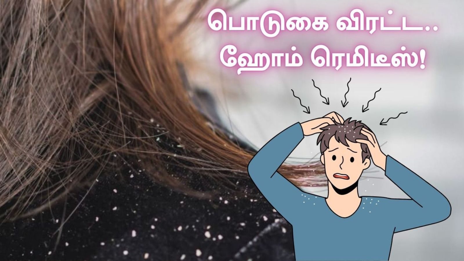பொடுகு தொல்லையா.? வீட்டிலிருந்த படியே இந்த இயற்கை ஹேர் பேக்குகளை டிரை பண்ணுங்க..