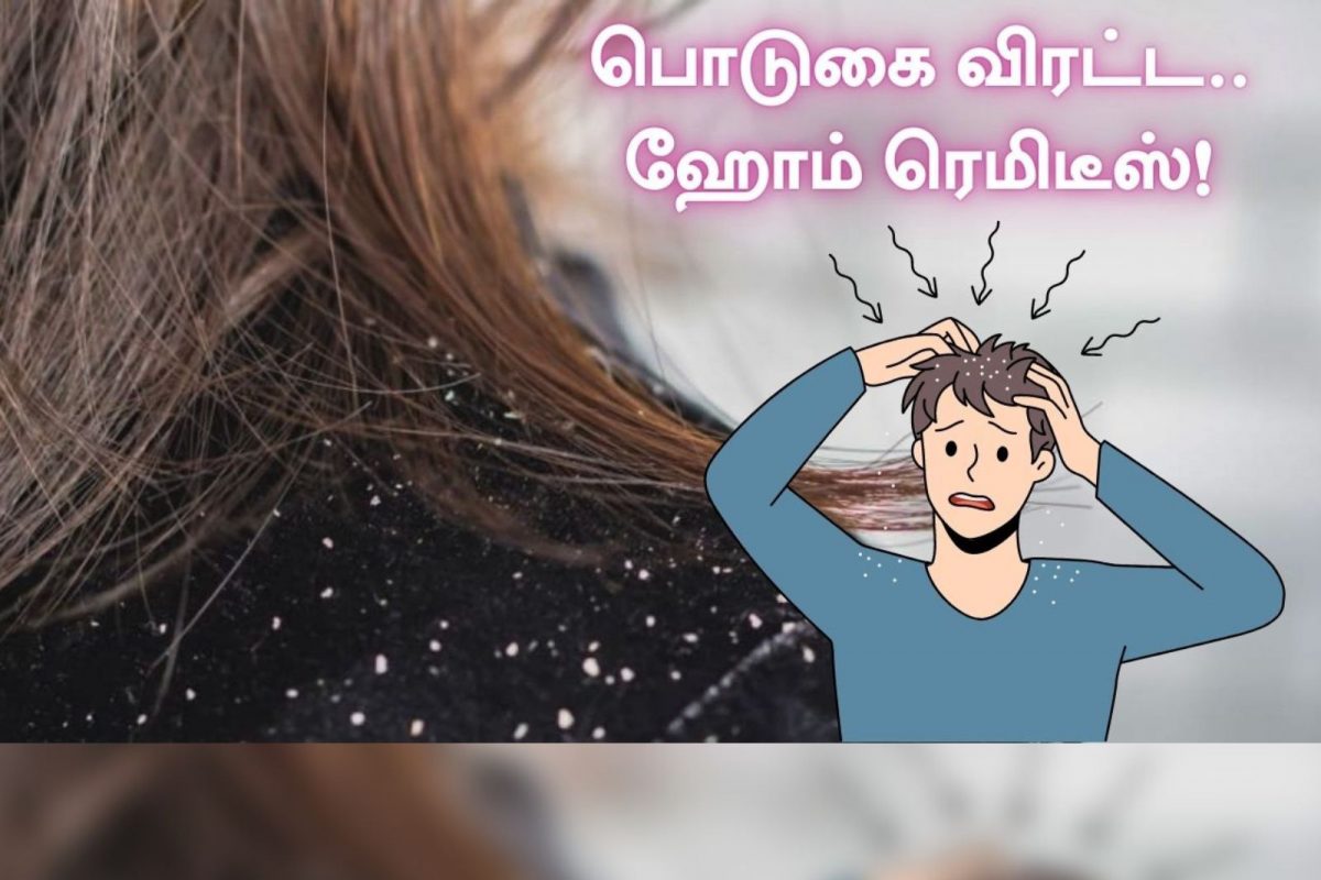இயற்கையான முறையை பயன்படுத்தி பொடுகு தொல்லையிலிருந்து விடுபட எளிய வழி..