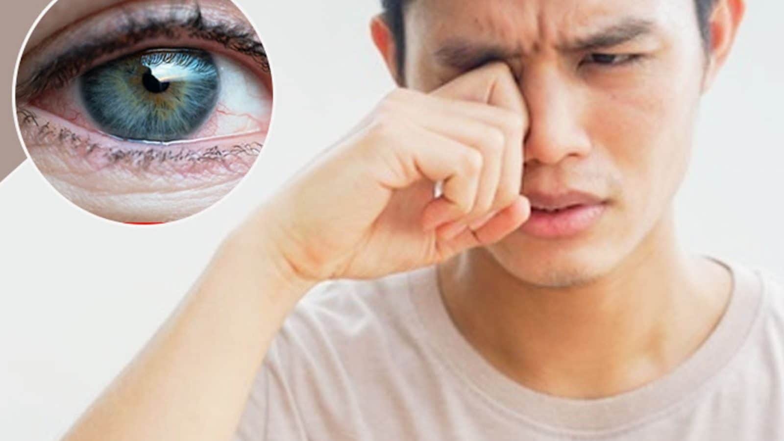 நீரிழிவு நோயால் பாதிக்கப்பட்டவர்களுக்கு கண்பார்வை பாதிக்கப்படலாம்.. மருத்துவர் சொல்லும் ஆலோசனை..!