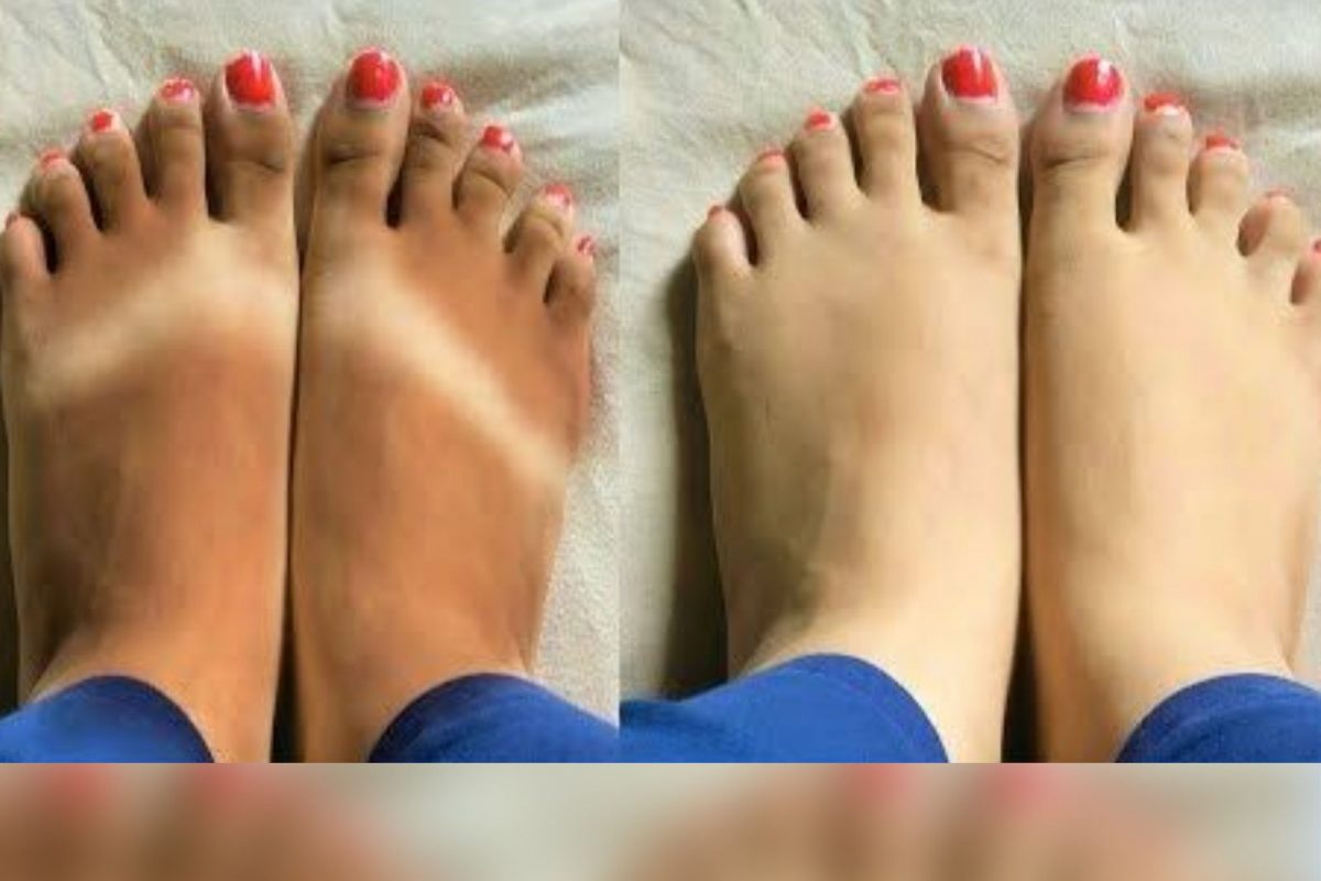 கால்கள் நிறம் மாறி கருமையா இருக்கா..? இந்த எளிய ஹோம் ரெமிடிஸ்