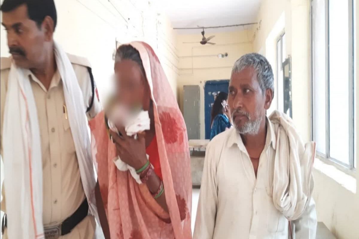 மனைவி விட்டு பிரிந்த ஆத்திரத்தில் மாமியாரின் மூக்கை அறுத்த மருமகன்..