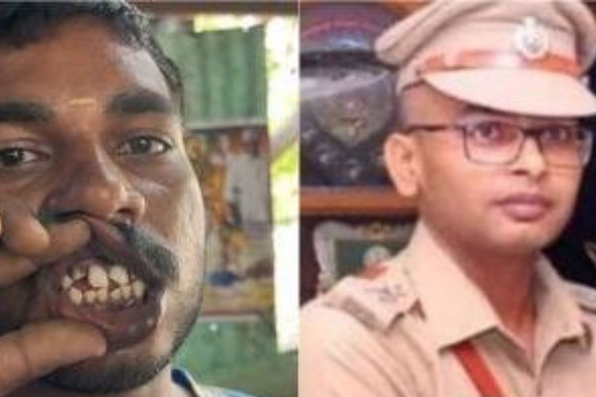 கைதிகளின் பற்கள் பிடுங்கப்பட்ட விவகாரம்