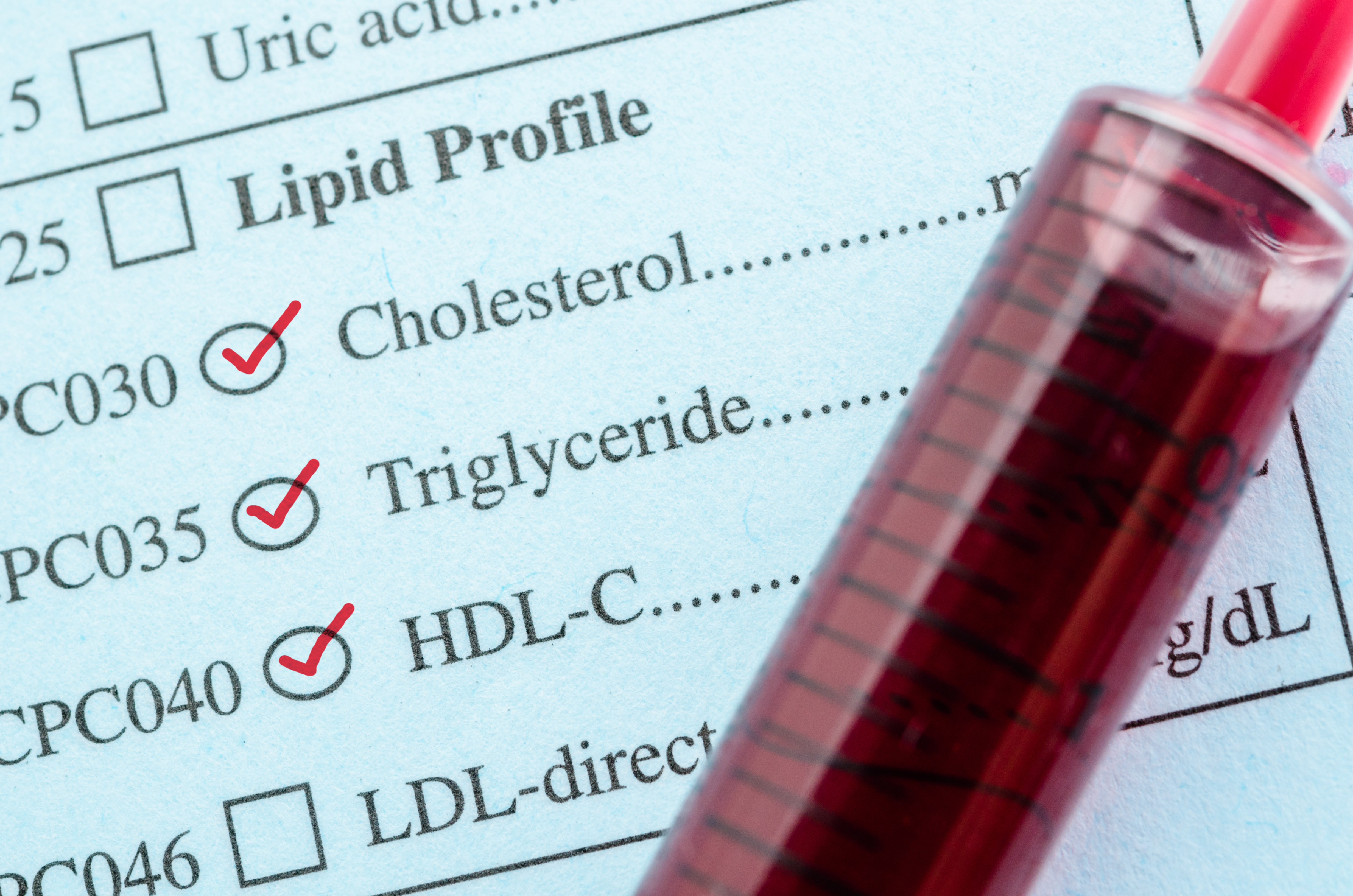  மேலும் Triglycerides என்பவை ரத்தத்தில் காணப்படும் மற்றொரு வகை கொழுப்பு ஆகும், இது இதய நோய் அபாயத்தை அதிகரிக்கும். தற்போது இங்கே உங்கள் கொலஸ்ட்ரால் லெவலை அதிகரிக்க கூடிய சில உணவுகளை பார்க்கலாம்.