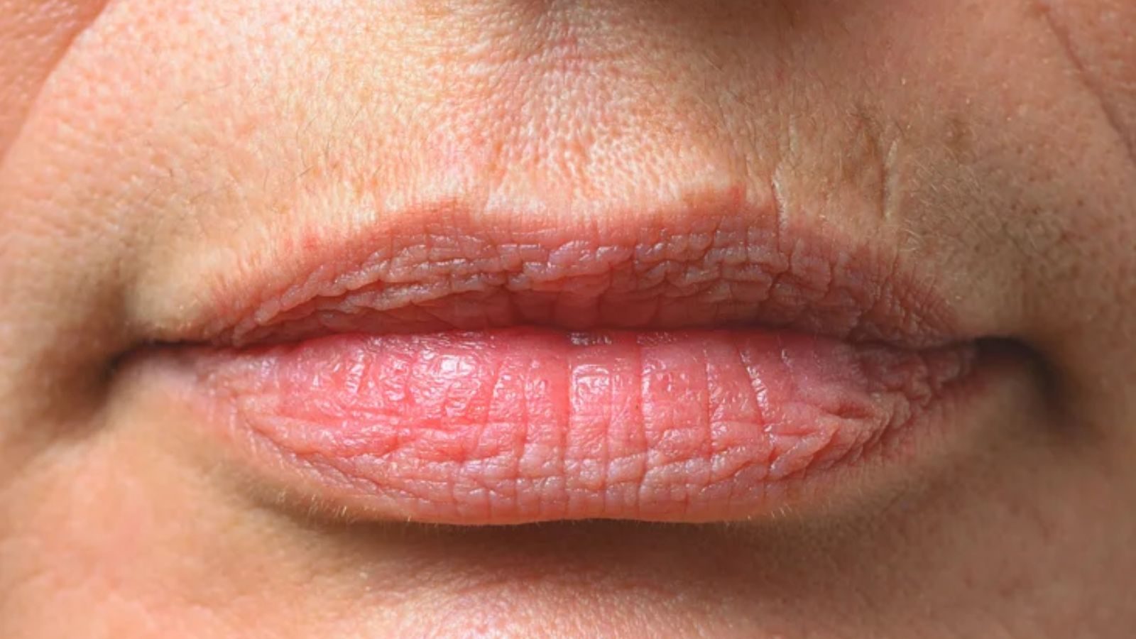 உதட்டில் உண்டாகும் சுருக்கங்களை நீக்க வேண்டுமா..? தினமும் இதை செய்யுங்கள்..!