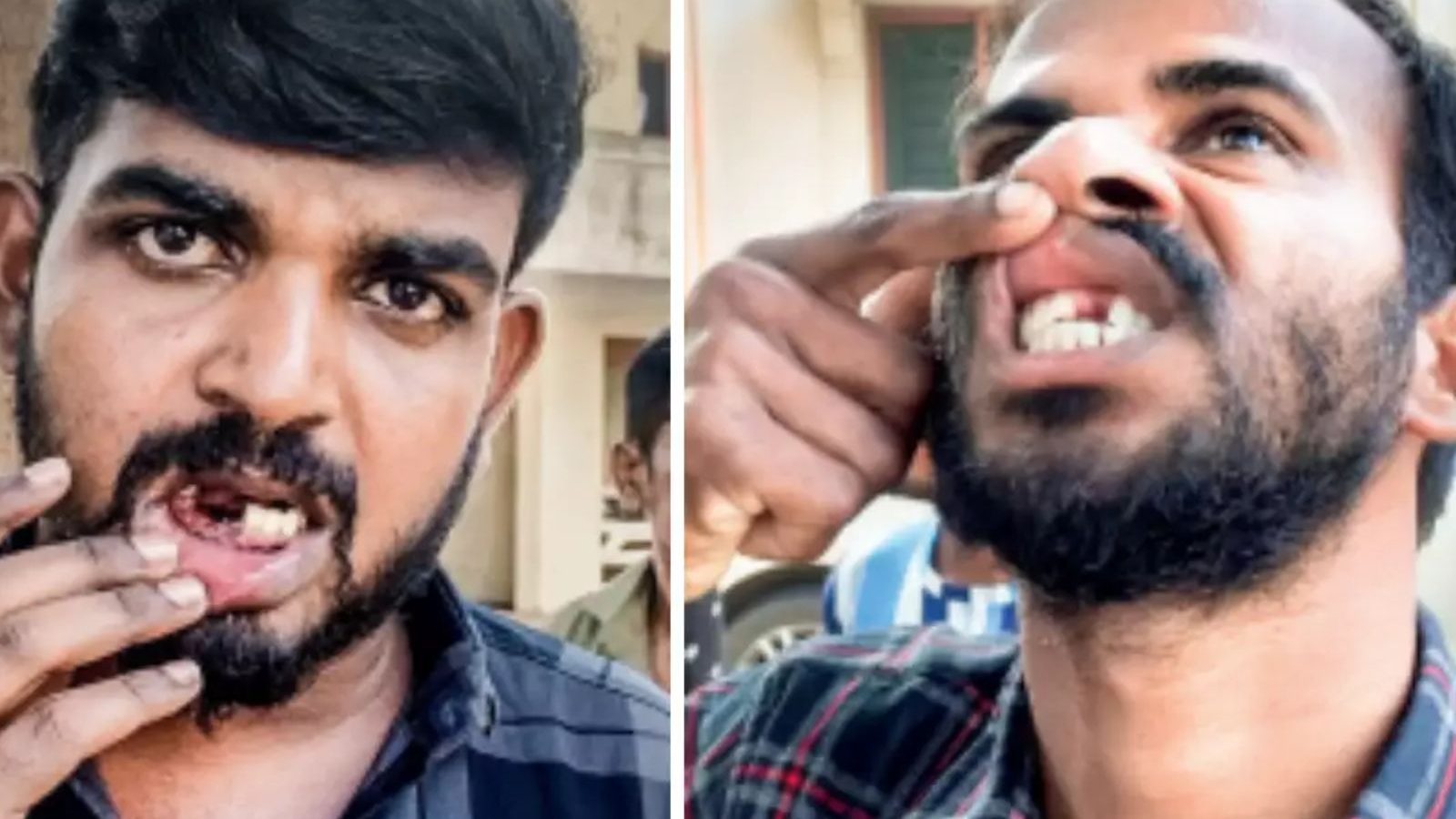 விசாரணைக் கைதிகளின் பல்லைப் பிடுங்கிய விவகாரம்- 24 காவலர்கள் பணியிட மாற்றம்...