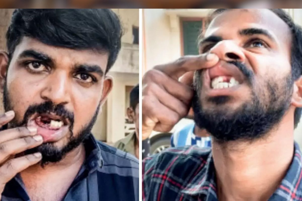 பாதிக்கப்பட்டவர்கள்