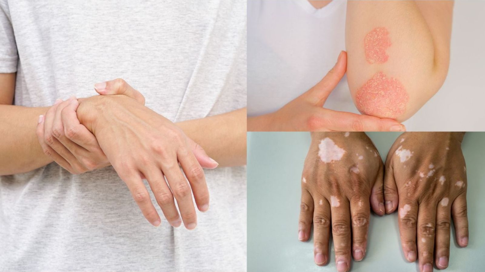 Autoimmune disorder : ஆட்டோ இம்யூன் கோளாறு என்றால் என்ன..? அறிகுறிகள் எப்படி இருக்கும்..?