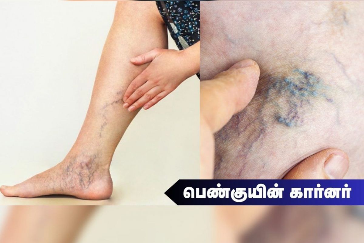 பெண்குயின் கார்னர் 85