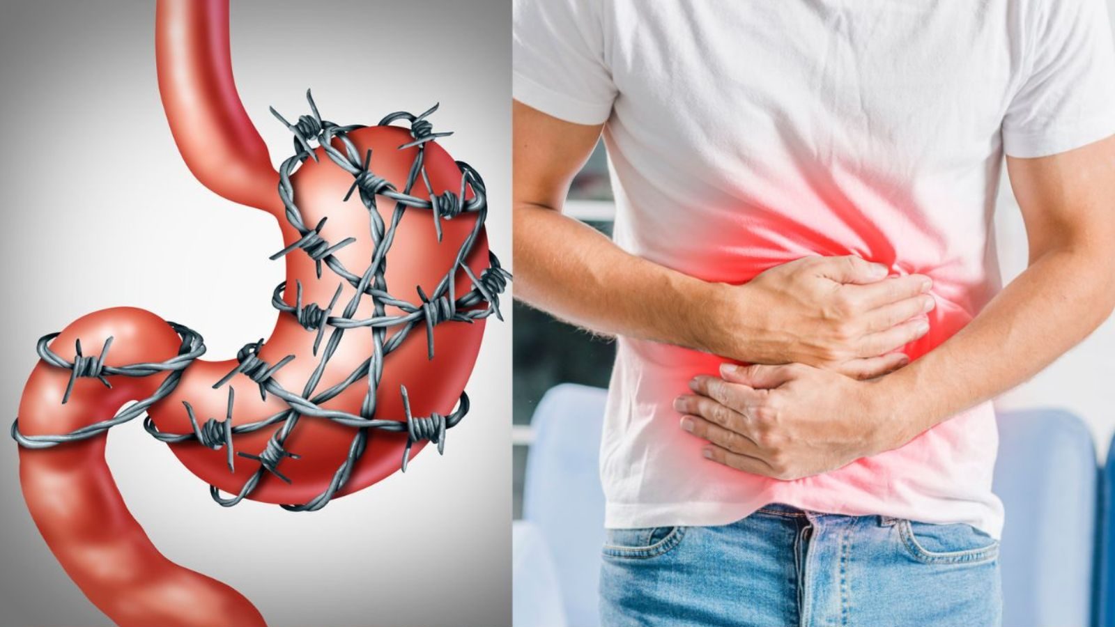 இரைப்பை வாதம் நோய் என்றால் என்ன..? அறிகுறிகள் மற்றும் காரணங்களை தெரிஞ்சுக்கோங்க..!