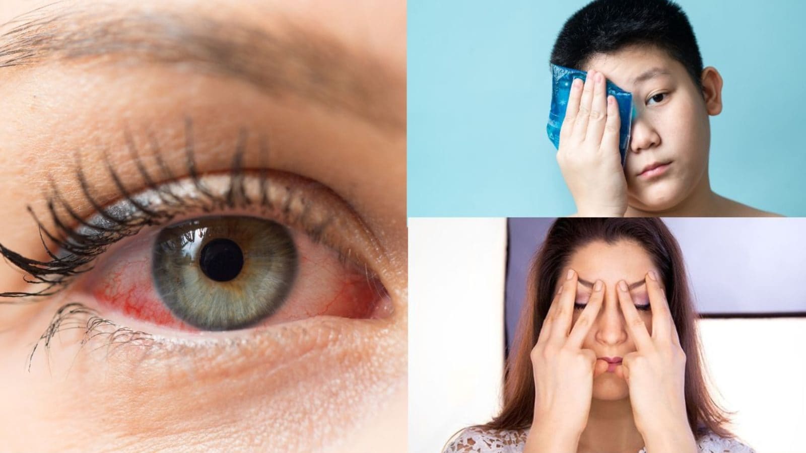 சிவந்த கண்களை உடனே சரி செய்யும் வீட்டு வைத்தியங்கள்..!