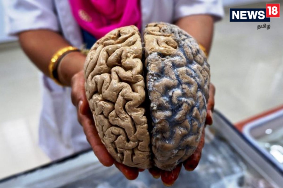 உண்மையான மனித மூளைகளைக் கொண்ட இந்தியாவின் ஒரே அருங்காட்சியகம்!