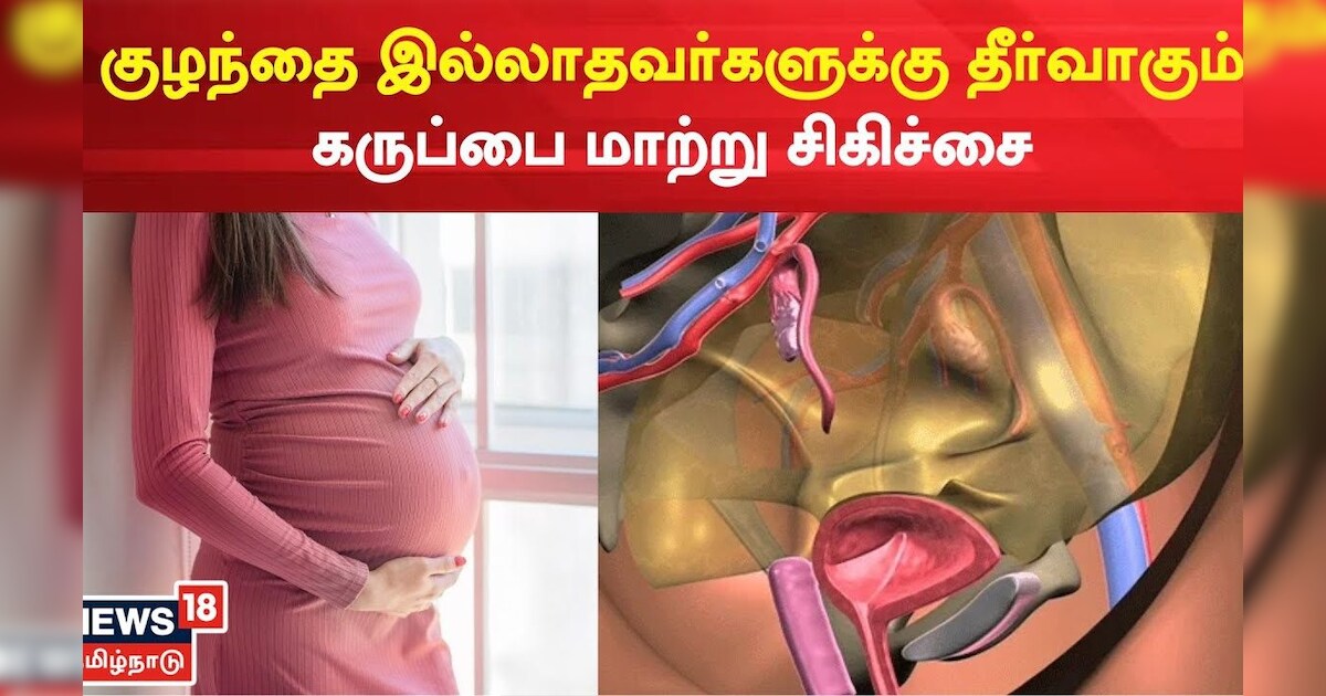 Uterus Transplant குழந்தை இல்லாதவர்களுக்கு தீர்வாகும் கருப்பை மாற்று
